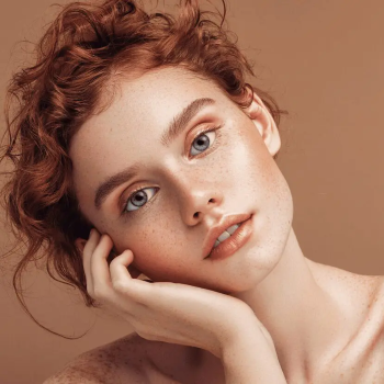 Tear trough filler model